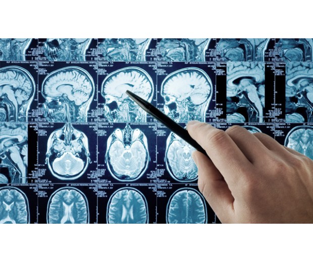 Wizyta u lekarza specjalisty neurochirurga NEUROCHIRURG 